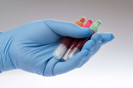 Doctor, laboratory staff keeps blood samples in hand