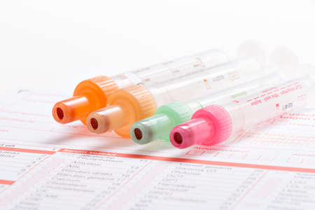 Blood samples are on a laboratory form for Finding out the blood values