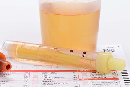 Urine and blood sample on a form for examinationの写真素材