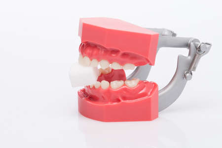Denture with mouth mirror, denture model
