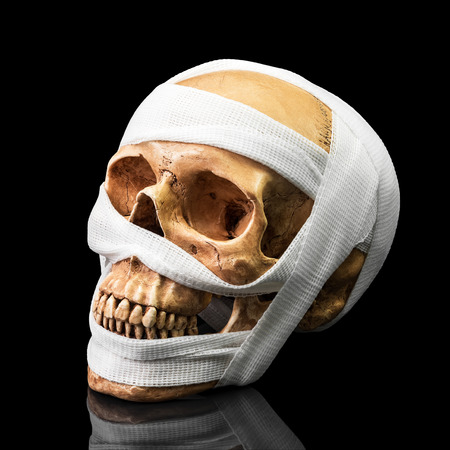 Human skull bind with bandage on dark backgroundの写真素材