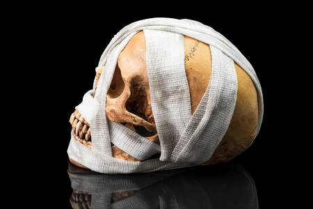 Human skull bind with dirty bandage on dark backgroundの写真素材
