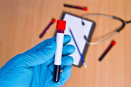 Vacuum tubes for medical work with blood samples in the laboratory. Coronavirus test. Doctor's hand in a rubber medical gloveの写真素材