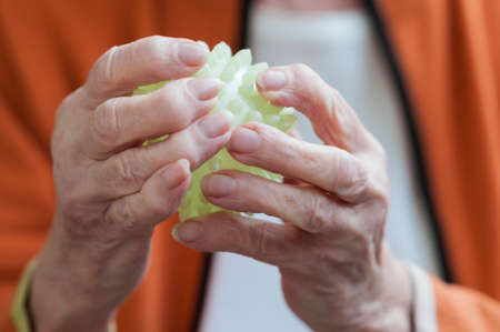 Application in physiotherapy, Senior massaging her hands with a spiky ballの写真素材