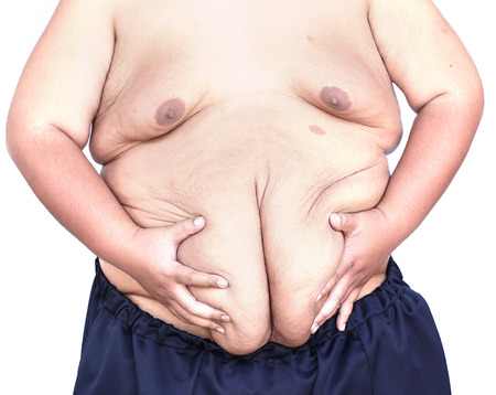 Fat man with a big bellyの写真素材