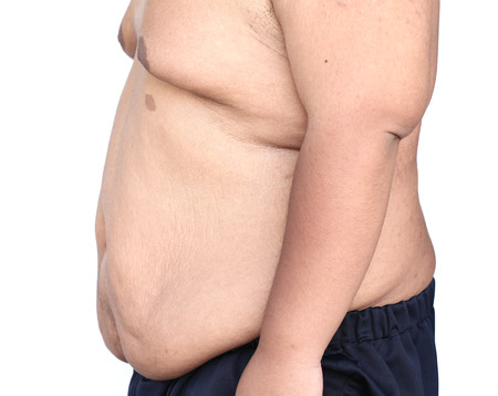 Fat man with a big bellyの写真素材