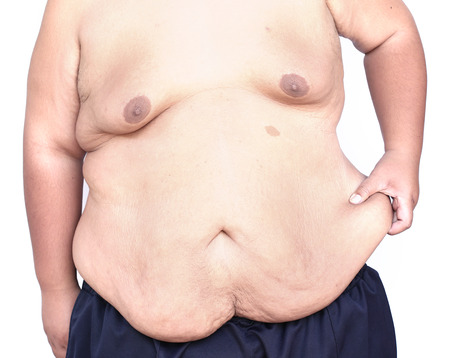 Fat man with a big bellyの写真素材