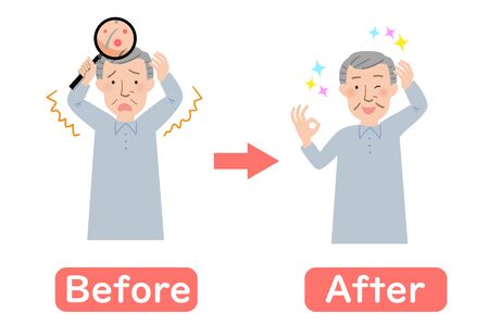 Before-after of Grandpa rash of the scalp is a concernのイラスト素材
