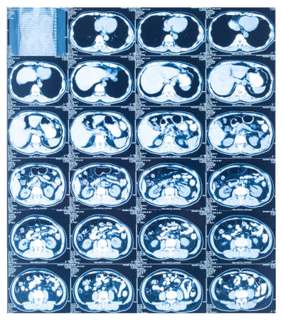 Medical diagnosis background. CT scanの写真素材