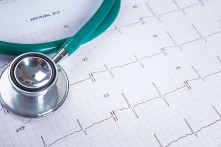Stethoscope on an electrocardiogram (ECG) chart backgroundの写真素材
