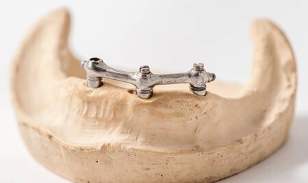 Dental Prothetic laboratory, technical shotsの写真素材