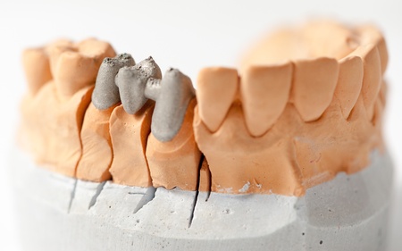 Dental Prothetic laboratory, technical shots