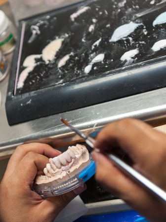 Dental prothesist at work at his laboratoryの写真素材