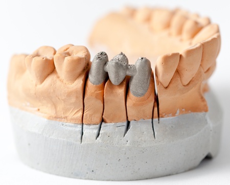 Dental Prothetic laboratory, technical shotsの写真素材