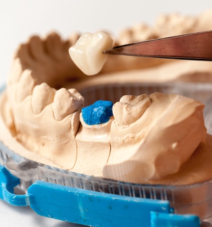 Dental Prothetic laboratory, technical shotsの写真素材