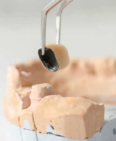 Technical shots on a dental prothetic laboratoryの写真素材