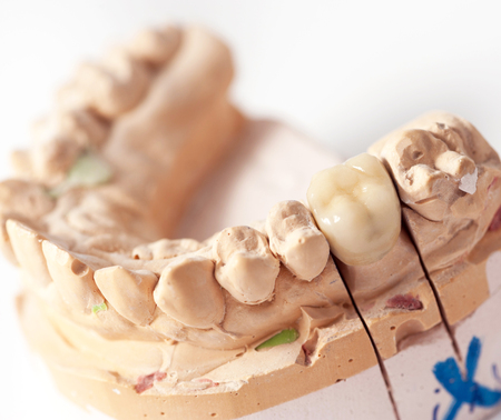 Technical shots on a dental prothetic laboratoryの写真素材