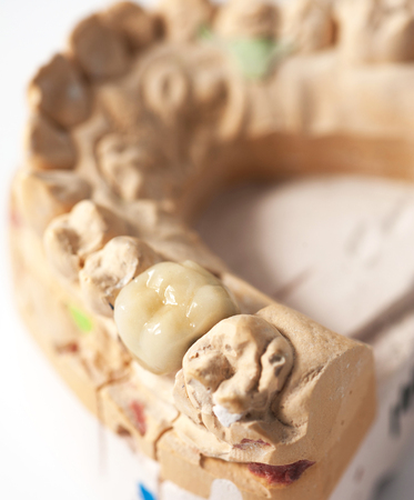 Technical shots on a dental prothetic laboratory
