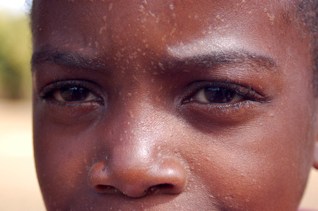 Africa -Tanzania - Village Pomerini - august 2013 - The Franciscan Mission for Humanitarian Aid - The look on the faces of the children of Africa, many of them sick with AIDS, a look for the futureのeditorial素材