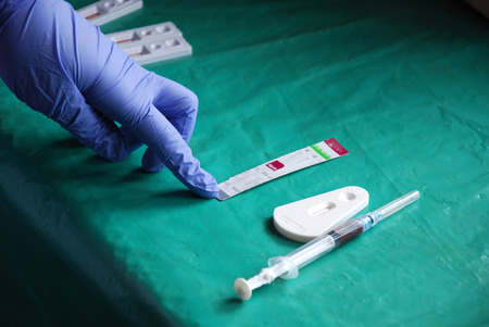 A doctor examines the blood to find out the positive to the AIDS virus