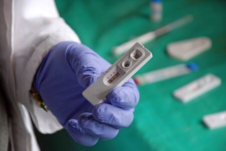 A doctor examines the blood to find out the positive to the AIDS virus