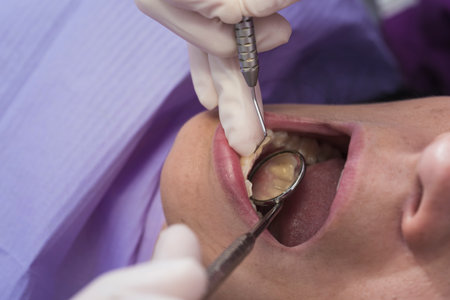 close-up photo of dentist in gloves checking teeth health of female patient with dental mirror in...