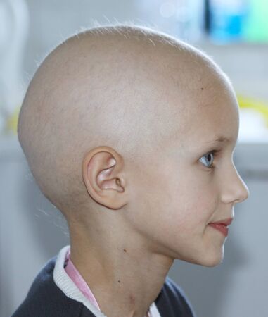 profile of a caucasian child showing hair loss due to chemotherapy treatment for cancerの写真素材