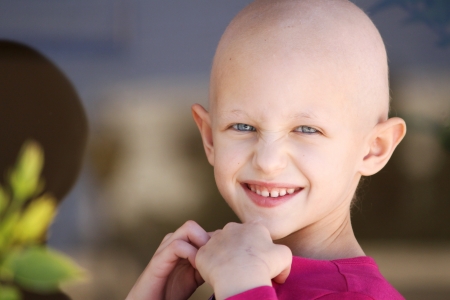 happy child with hair loss because of chemotherapyの写真素材