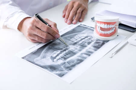 Male doctor or dentist writing report working with tooth x-ray film, model and equipment used in the treatment of dental and dentistry at workplace.の写真素材