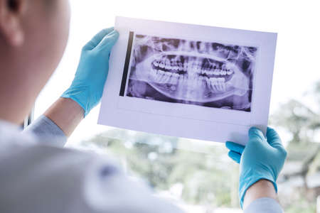 Image of male doctor or dentist holding and looking at dental x-ray.