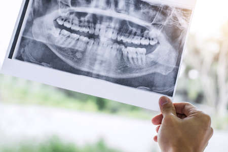 Image of male doctor or dentist holding and looking at dental x-ray.