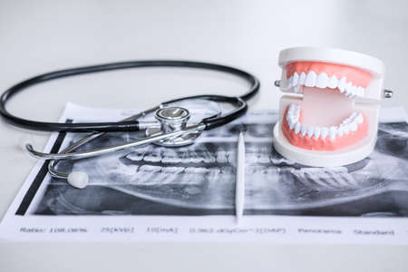 Dental model and equipment on tooth x-ray film and stethoscope used in the treatment of dental and dentistry by dentist.の写真素材