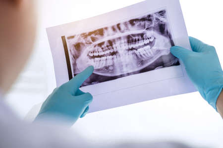 Image of male doctor or dentist holding and looking at dental x-ray.