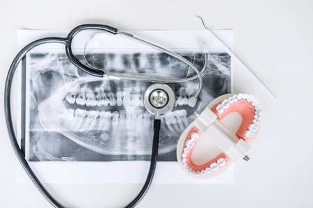 Dental model and equipment on tooth x-ray film and stethoscope used in the treatment of dental and dentistry by dentist, top view.の写真素材