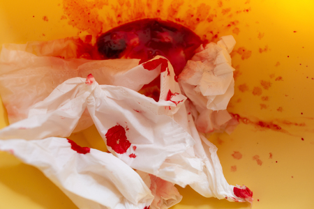 blood and bloody tissue in a bowlの写真素材