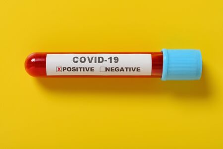 a covid-19 blood test tube with result of positive on yellow background