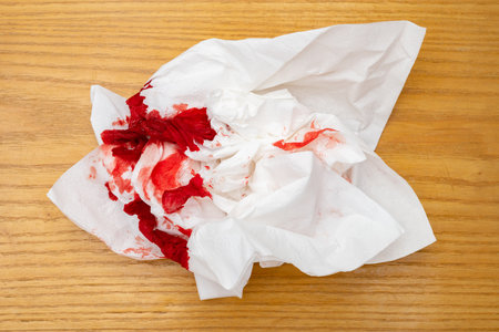 top view bloody tissue on a wood tableの写真素材