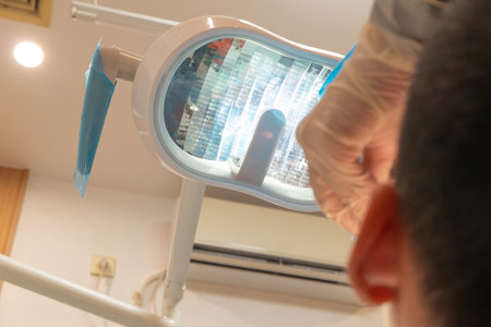a dentist examines a boys teethの写真素材