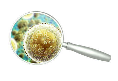 Magnifying glass and pathogenic bacterias and viruses. Fast multiplication of bacteria. Infection and microbe. Isolated on white background. 3d renderの写真素材