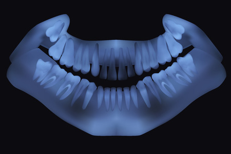 Panoramic dental X-Ray. Vector illustrationのイラスト素材