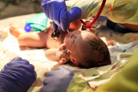 The first minutes of life of the newborn girlの写真素材