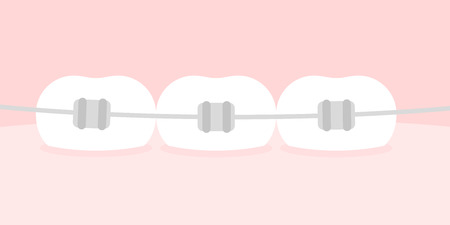Teeth braces. Flat illustration