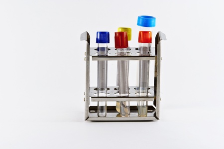 Some Blood and Serum tubes for labs