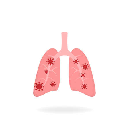 Infected lungs. Microscopic viruses infected by the lungs flat design. Coronavirus concept. Isolated vector illustration.のイラスト素材