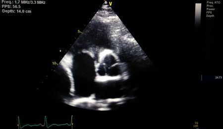 Heart Scan