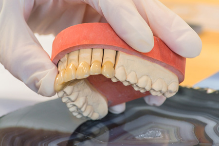 Dentures, prosthesis and oral hygiene. Hands with gloves while working on a dental prosthesis.の写真素材