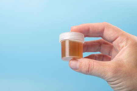 hand with test tube, urinalysis on blue background with copy spaceの写真素材