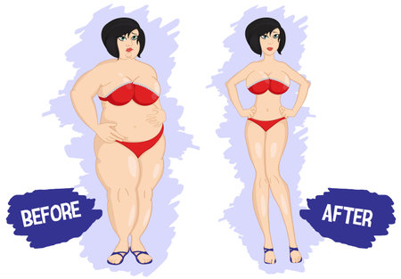 Before and after weight loss fat and slim woman. Losing weight. Dieting. Fat and thin woman before and after. Girl in swimsuit. Weight loss concept. Vector illustration. Fitness. Lifestyle. Isolated.のイラスト素材