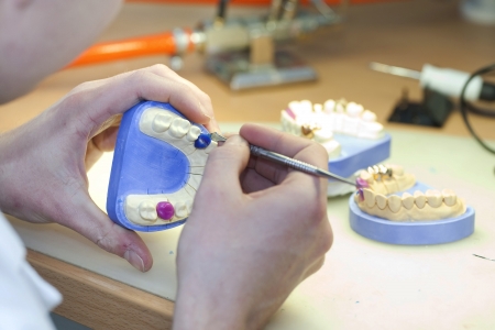 Dental Laboratory - teeth prostheticsの写真素材