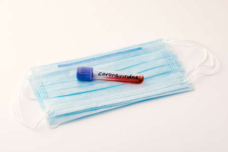 A positive blood test result for a new rapidly spreading coronavirus. concept of medicine and health...